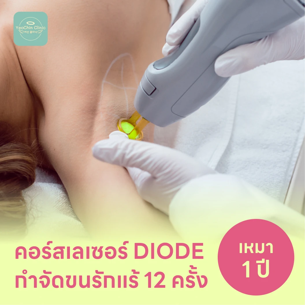 คอร์สเลเซอร์กำจัดขนรักแร้ 12 ครั้ง ด้วย Diode Laser แพ็กเกจ HDmall+ ที่ YeoChin Clinic ยอชินคลินิกเวชกรรม