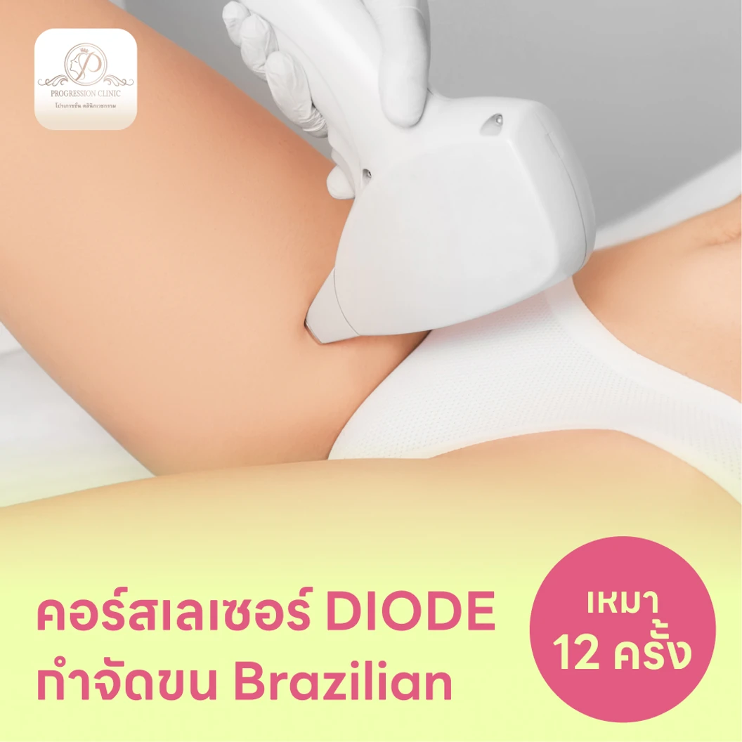 คอร์สเลเซอร์กำจัดขนน้องสาวแบบ Brazilian vVI 12 ครั้ง ด้วย Diode Laser แพ็กเกจ HDmall+ ที่ Progression Clinic