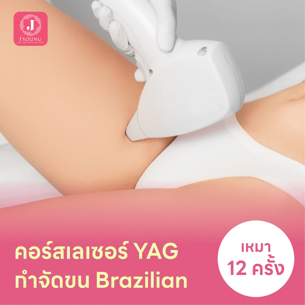 คอร์สเลเซอร์กำจัดขนน้องสาวแบบ Brazilian vVI 12 ครั้ง ด้วย YAG Laser แพ็กเกจ HDmall+ ที่ J Young Clinic เจยังคลินิกเวชกรรม