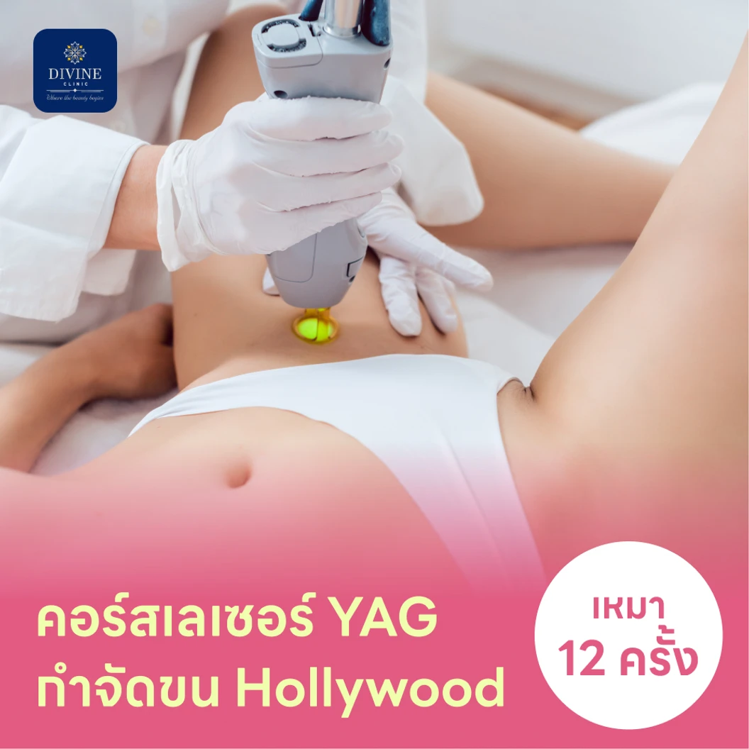 คอร์สเลเซอร์กำจัดขนน้องสาวแบบ Hollywood vVIO 12 ครั้ง ด้วย YAG Laser แพ็กเกจ HDmall+ ที่ Divine Aesthetic Clinic