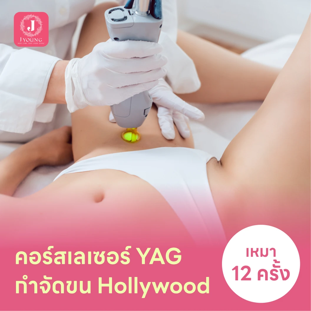 คอร์สเลเซอร์กำจัดขนน้องสาวแบบ Hollywood vVIO 12 ครั้ง ด้วย YAG Laser แพ็กเกจ HDmall+ ที่ J Young Clinic เจยังคลินิกเวชกรรม