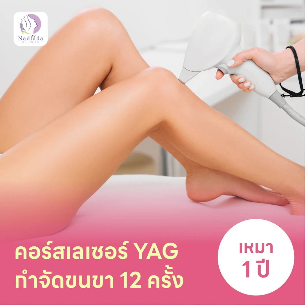 คอร์สเลเซอร์กำจัดขนขา 12 ครั้ง ด้วย YAG Laser แพ็กเกจ HDmall+ ที่ Nadlada Clinic