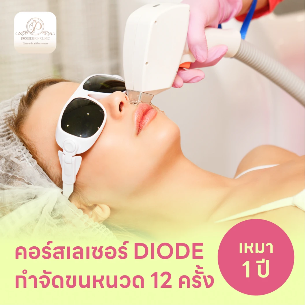 คอร์สเลเซอร์กำจัดขนหนวด 12 ครั้ง ด้วย Diode Laser แพ็กเกจ HDmall+ ที่ Progression Clinic