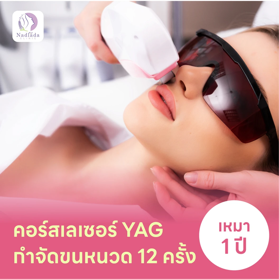 คอร์สเลเซอร์กำจัดขนหนวด 12 ครั้ง ด้วย YAG Laser แพ็กเกจ HDmall+ ที่ Nadlada Clinic