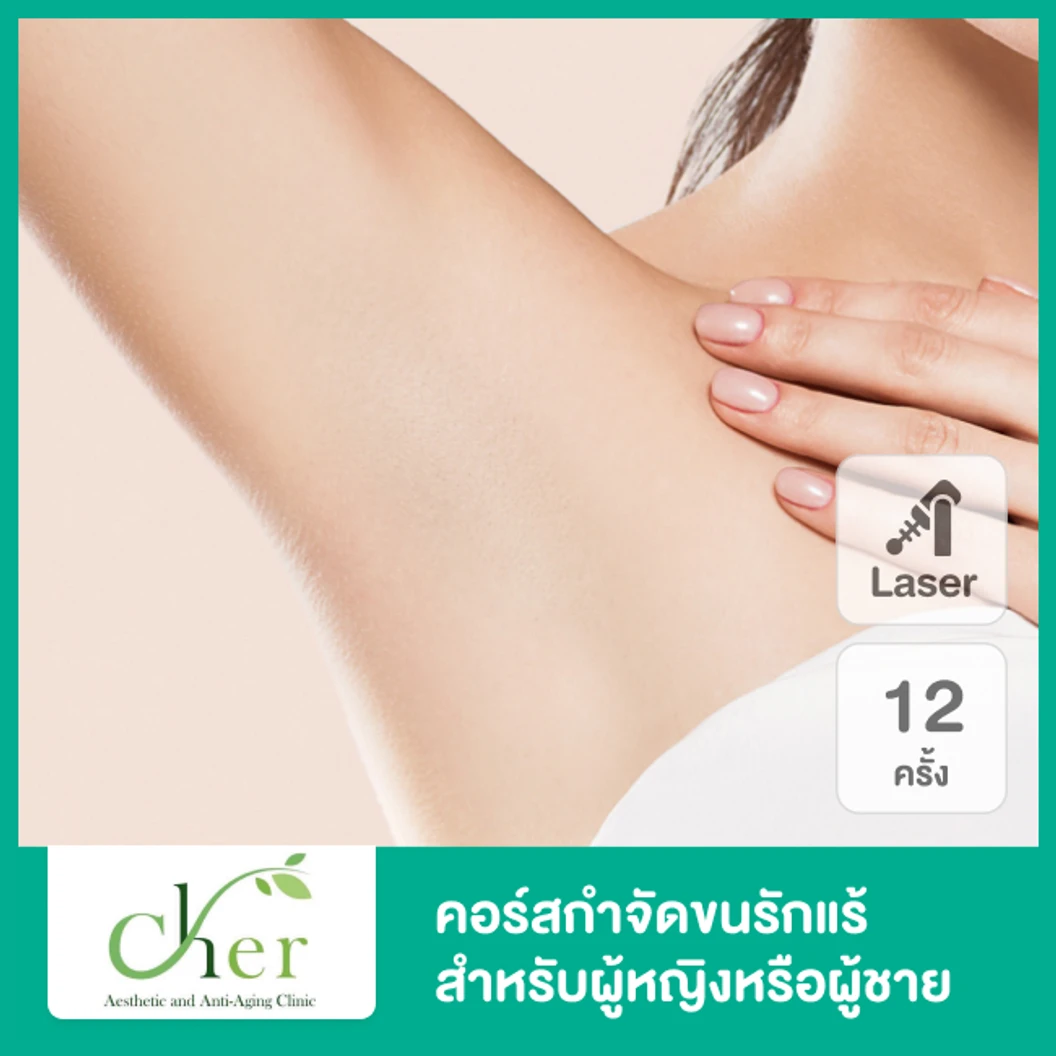 คอร์สเลเซอร์ Cool 3 Wavelength Diode กำจัดขนรักแร้ 1 ปี 12 ครั้ง ที่ Cher Clinic