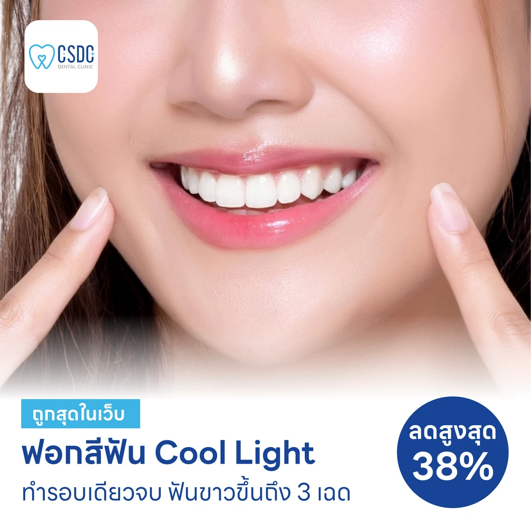 ฟอกสีฟันที่คลินิก ด้วยระบบ Cool Light แพ็กเกจHDmall+ ที่ CSDC