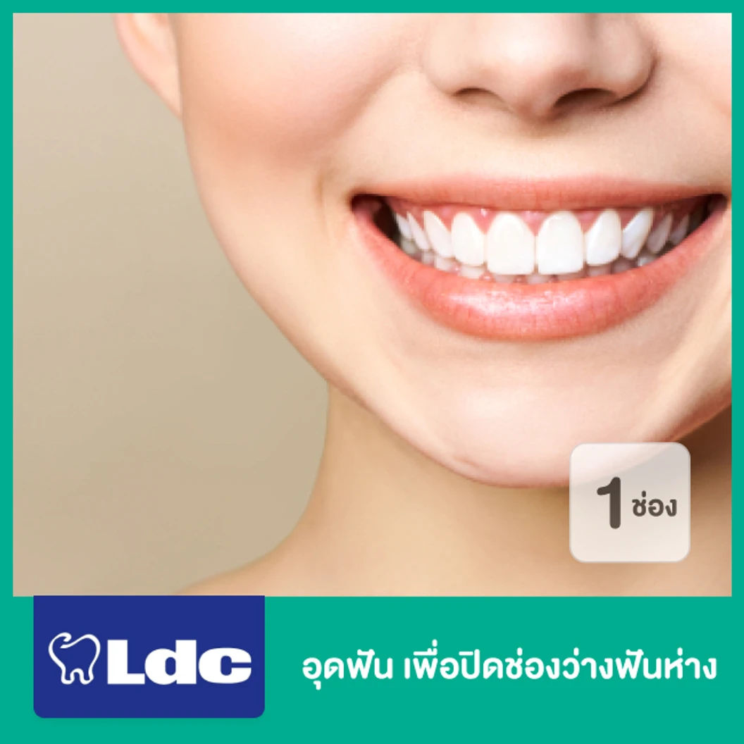อุดฟัน เพื่อปิดช่องว่างฟันห่าง 1 ช่อง ที่ LDC Dental