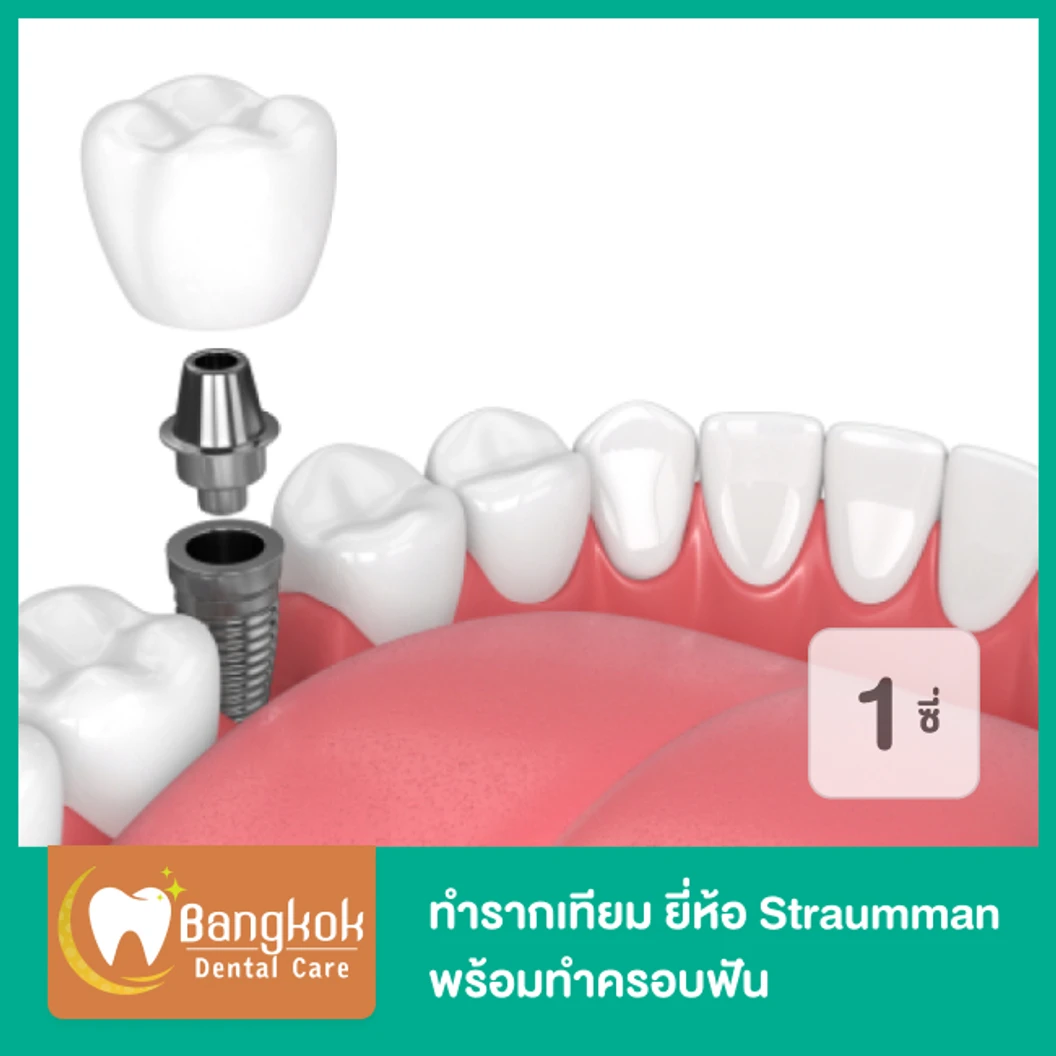 ทำรากฟันเทียม ยี่ห้อ Straumman พร้อมทำครอบฟัน สำหรับฟัน 1 ซี่ ที่ Bangkok Dental Care