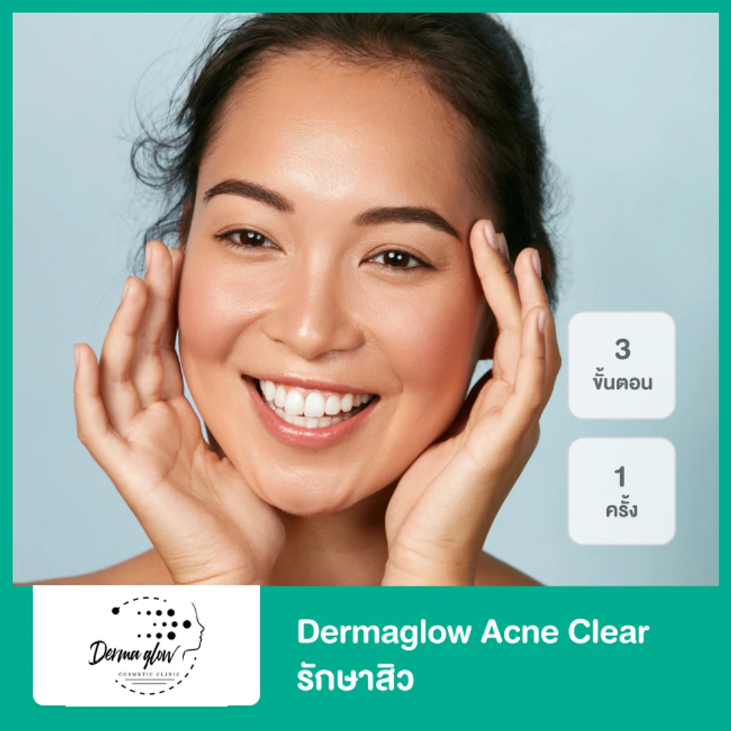 Dermaglow Acne Clear รักษาสิว 3 ขั้นตอน 1 ครั้ง ที่ DermaGlow Clinic