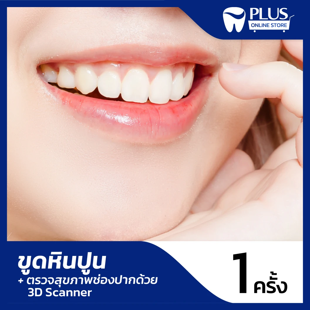 ขูดหินปูน + ตรวจสุขภาพช่องปาก ด้วย 3D Scanner ที่ PLUS Dental Clinic