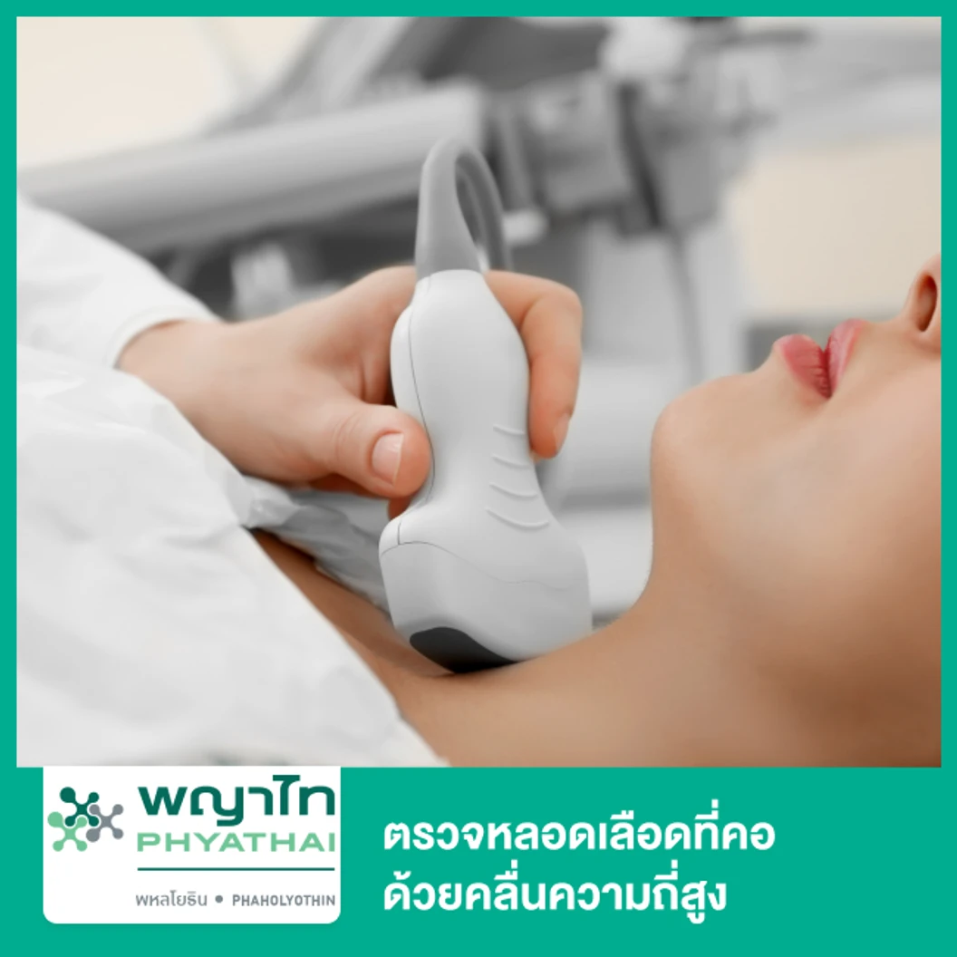 ตรวจหลอดเลือดที่คอ ด้วยคลื่นความถี่สูง Ultrasound Doppler Carotid Duplex ที่ โรงพยาบาลพญาไท พหลโยธิน