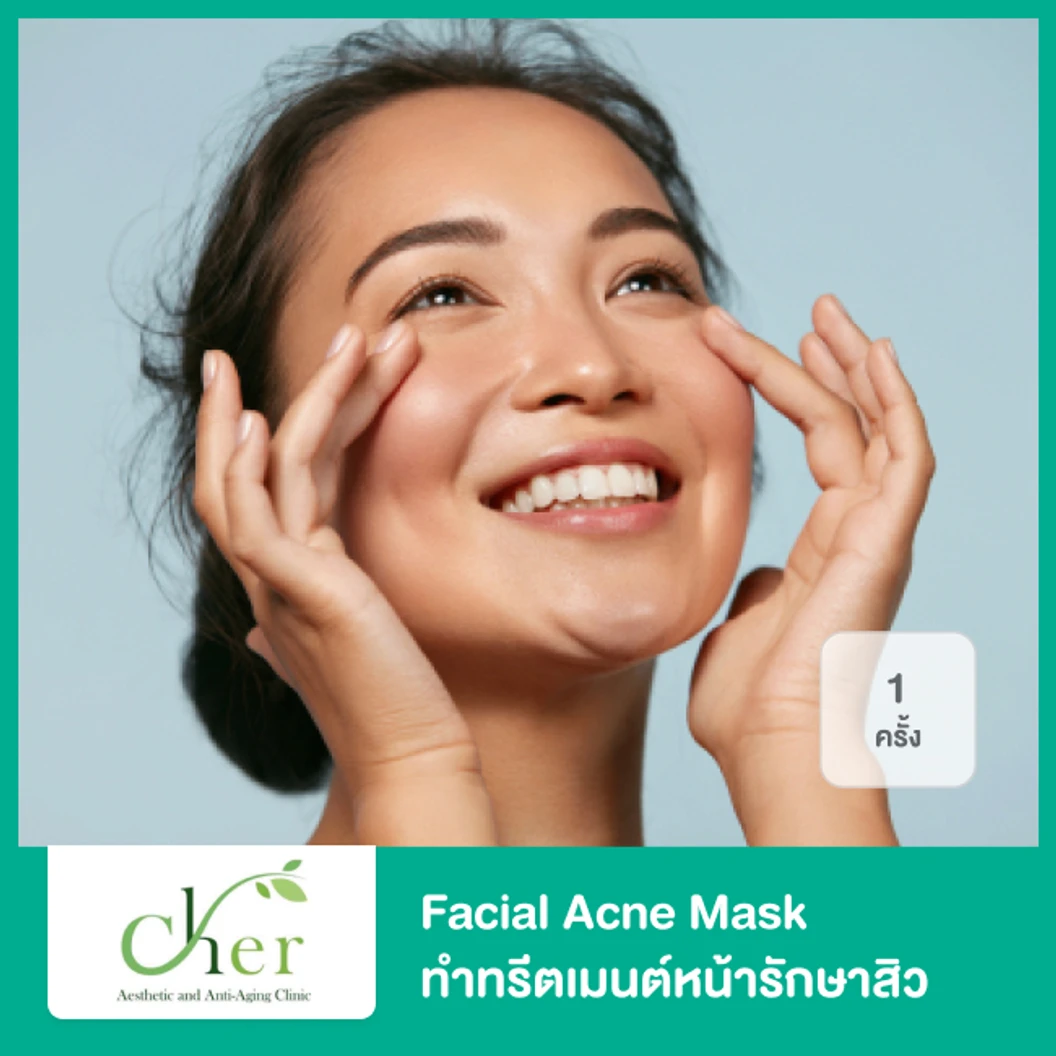 Facial Acne Mask ทำทรีตเมนต์หน้ารักษาสิว 1 ครั้ง ที่ Cher Clinic