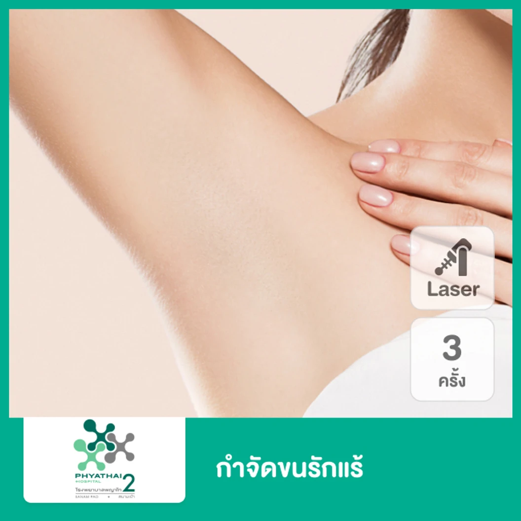 คอร์สเลเซอร์ Gentle YAG กำจัดขนรักแร้ 3 ครั้ง ที่ โรงพยาบาลพญาไท 2