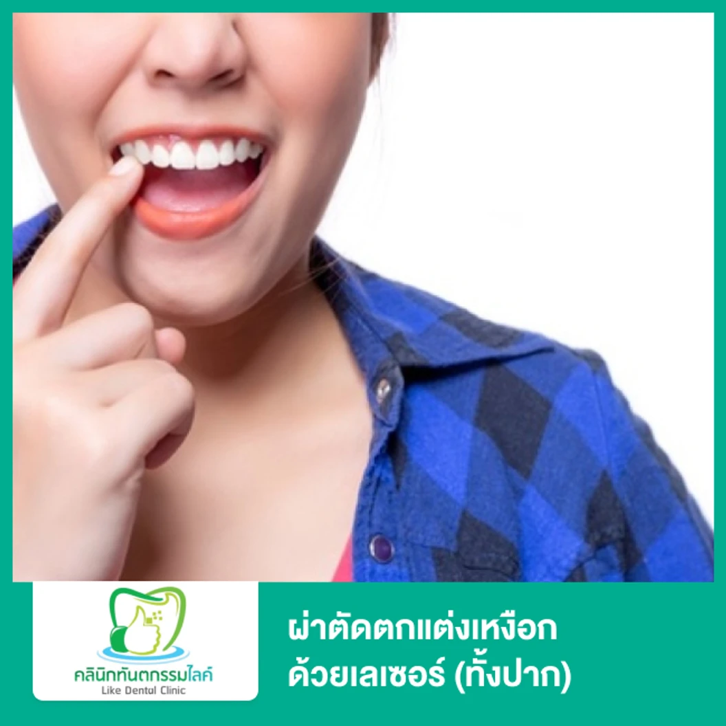 ผ่าตัดตกแต่งเหงือก ด้วยเลเซอร์ ทั้งปาก ที่ Like Dental Clinic