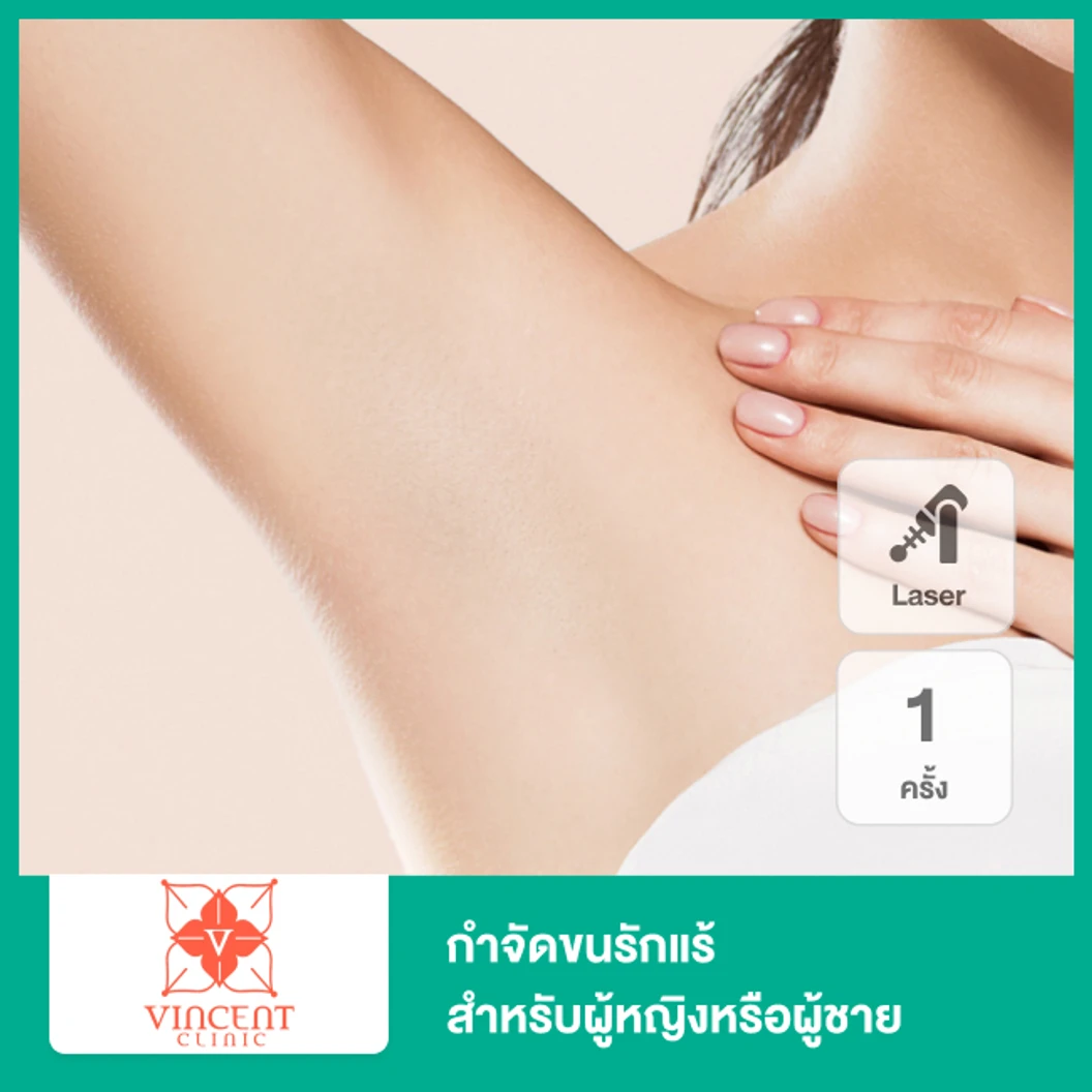 เลเซอร์ Primelase High Power Diode Laser 3 Wavelength กำจัดขนรักแร้ 1 ครั้ง ที่ Vincent Clinic