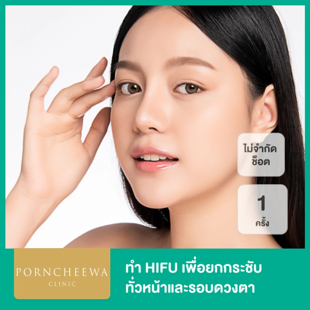 ทำ HIFU ด้วยเครื่อง Power Max Lift ไม่จำกัดช็อต ขึ้นอยู่กับแพทย์ประเมิน เพื่อยกกระชับทั่วหน้าและรอบดวงตา 1 ครั้ง ที่ Porncheewa Clinic