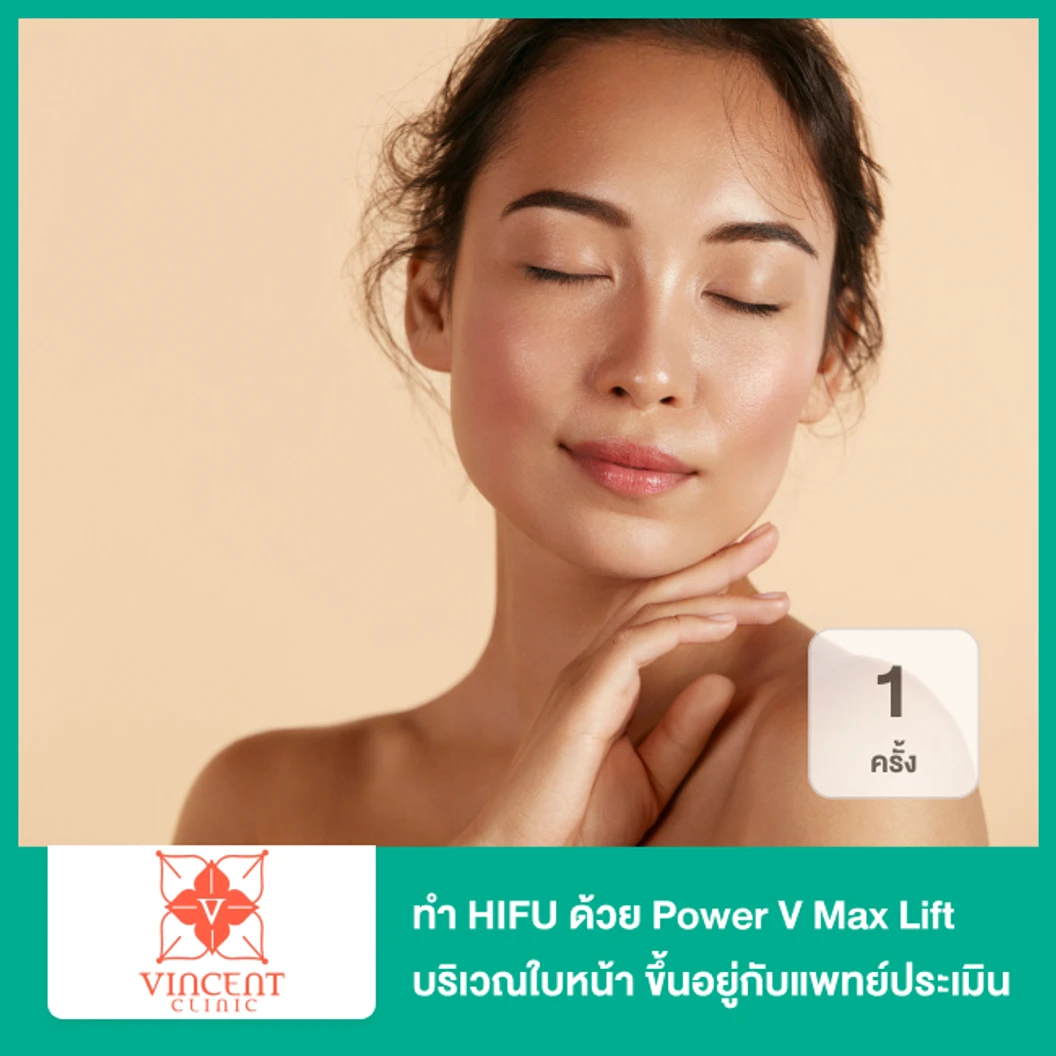 ทำ HIFU ด้วย Power V Max Lift บริเวณใบหน้า จำนวนช็อตขึ้นอยู่กับแพทย์ประเมิน 1 ครั้ง ที่ Vincent Clinic