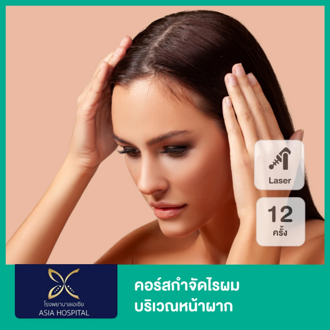 คอร์สกำจัดไรผมบริเวณหน้าผาก ด้วย SHR Laser 12 ครั้ง ที่ โรงพยาบาลเอเซีย