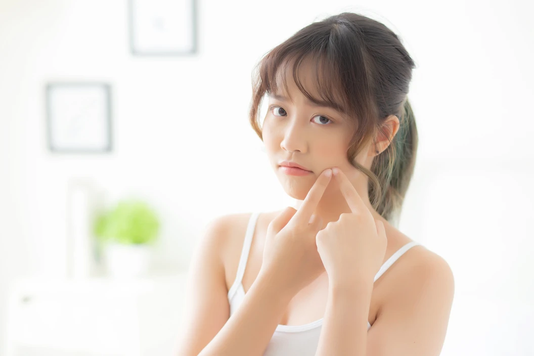 รักษาสิว 4 ขั้นตอน Acne Program 1 ครั้ง ที่ วลีรัตน์คลินิก Waleerat Clinic