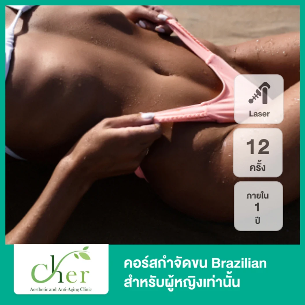 คอร์สกำจัดขน Brazilian ด้วย Diode Laser 12 ครั้ง ภายใน 1 ปี สำหรับผู้หญิงเท่านั้น ที่ Cher Clinic