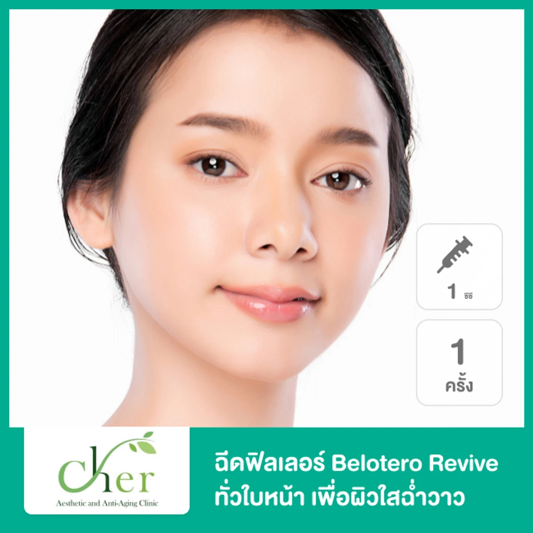 โปรแกรมฟิลเลอร์ 1 ซีซี หน้า ที่ Cher Clinic