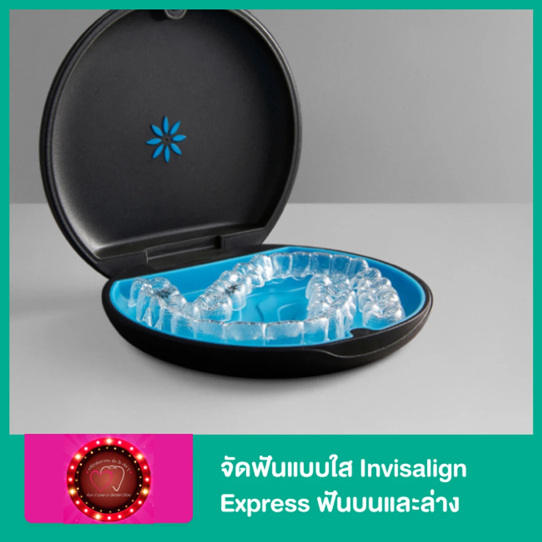 จัดฟันแบบใส Invisalign Express ฟันบนและล่าง ที่ คลินิกทันตกรรม ฟัน ไอ เลิฟ ยู