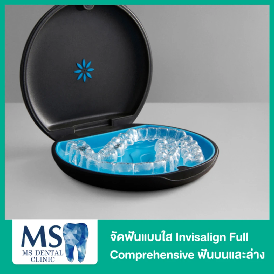 จัดฟันแบบใส Invisalign Full Comprehensive ฟันบนและล่าง ที่ MS Dental Clinic เอ็มเอสคลินิกทันตกรรม สุขุมวิท 39