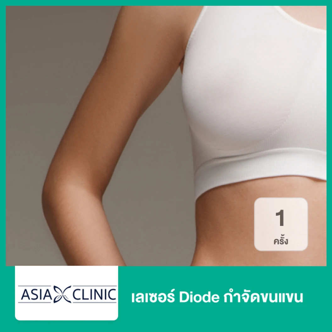 เลเซอร์ Diode กำจัดขนแขน 1 ครั้ง ที่ Asia Clinic เอเซียคลินิก