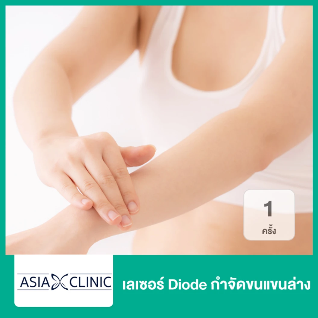 เลเซอร์ Diode กำจัดขนแขนล่าง 1 ครั้ง ที่ Asia Clinic เอเซียคลินิก