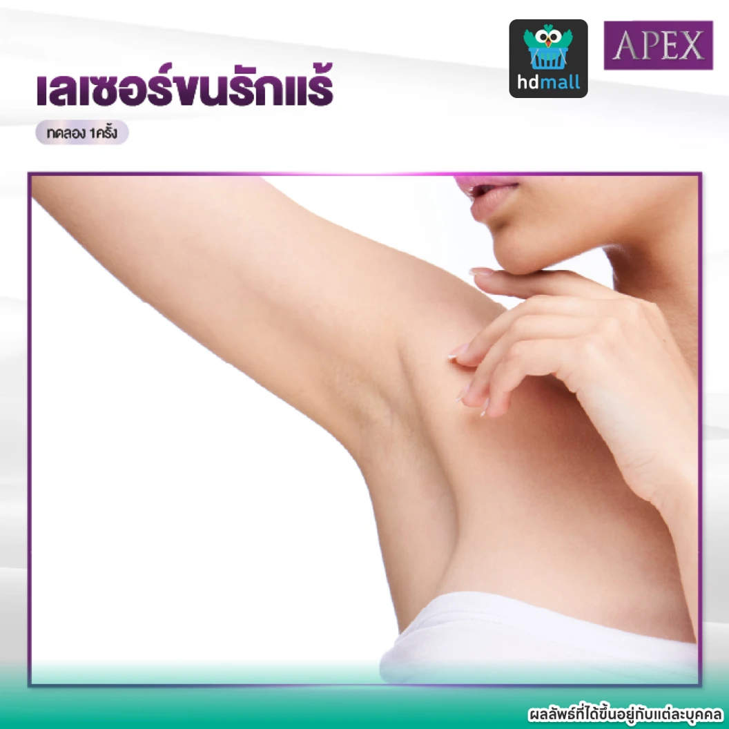 เลเซอร์ Dynamic Tech กำจัดขนรักแร้ 1 ครั้ง ราคาทดลอง ที่ APEX Medical Center