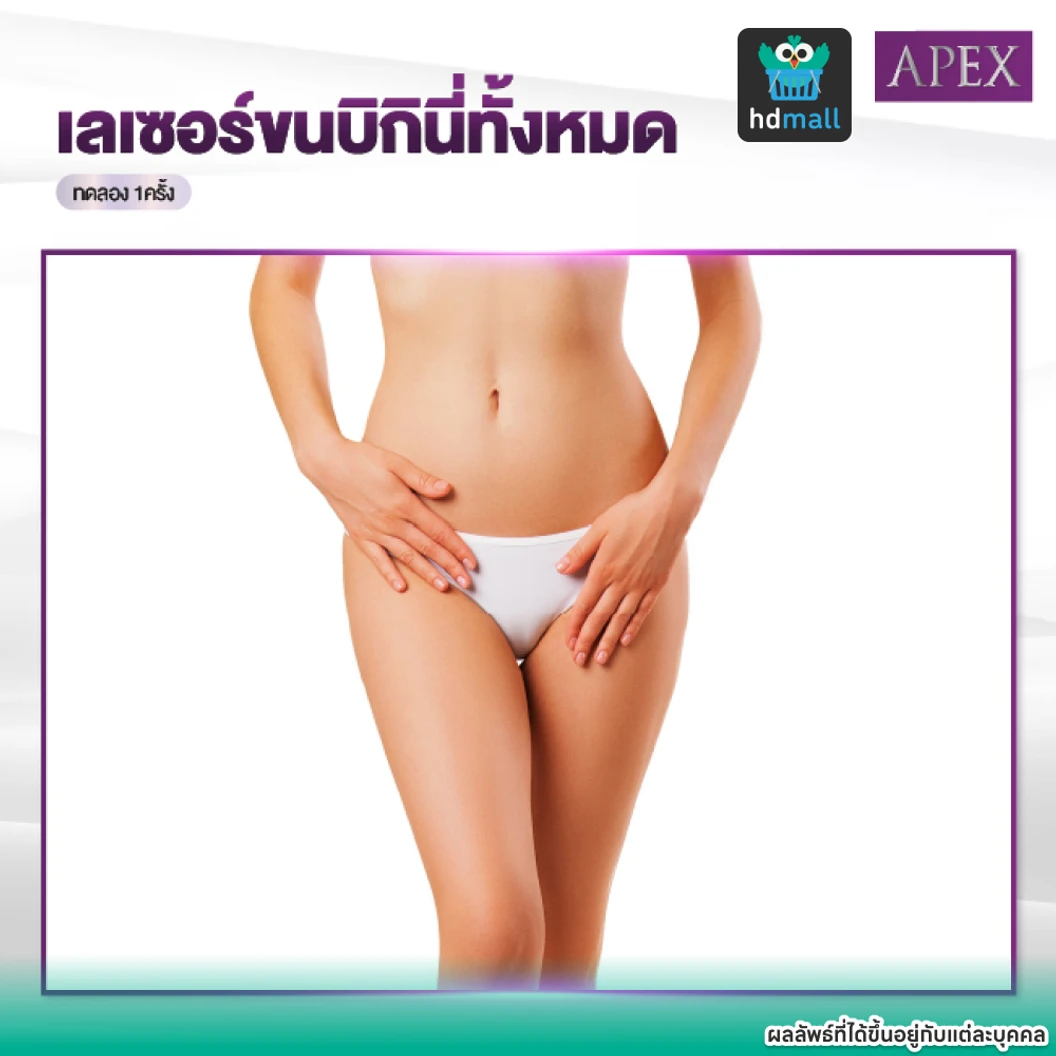 เลเซอร์ Dynamic Tech กำจัดขน Bikini V 1 ครั้ง ราคาทดลอง ที่ APEX Medical Center