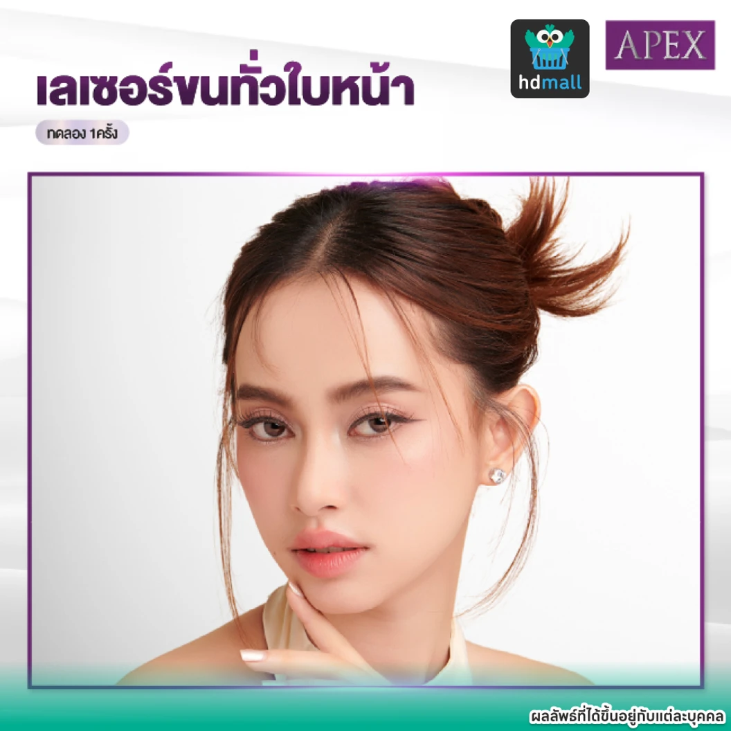 เลเซอร์ Dynamic Tech กำจัดขนหน้า 1 ครั้ง ราคาทดลอง ที่ APEX Medical Center