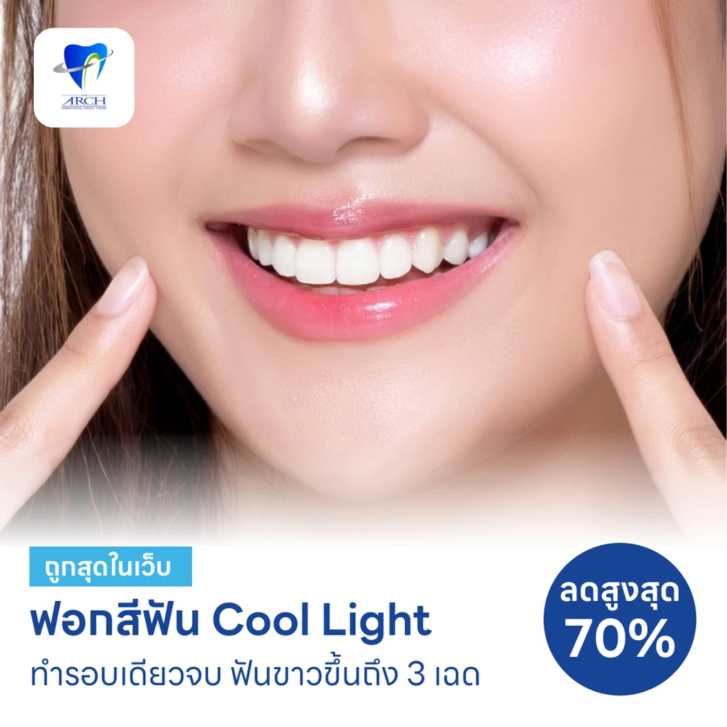 ฟอกสีฟันที่คลินิก ด้วยระบบ Cool Light แพ็กเกจ HDmall+ ที่ The ARCH Dental Center ศูนย์ทันตกรรมดิอาร์ช