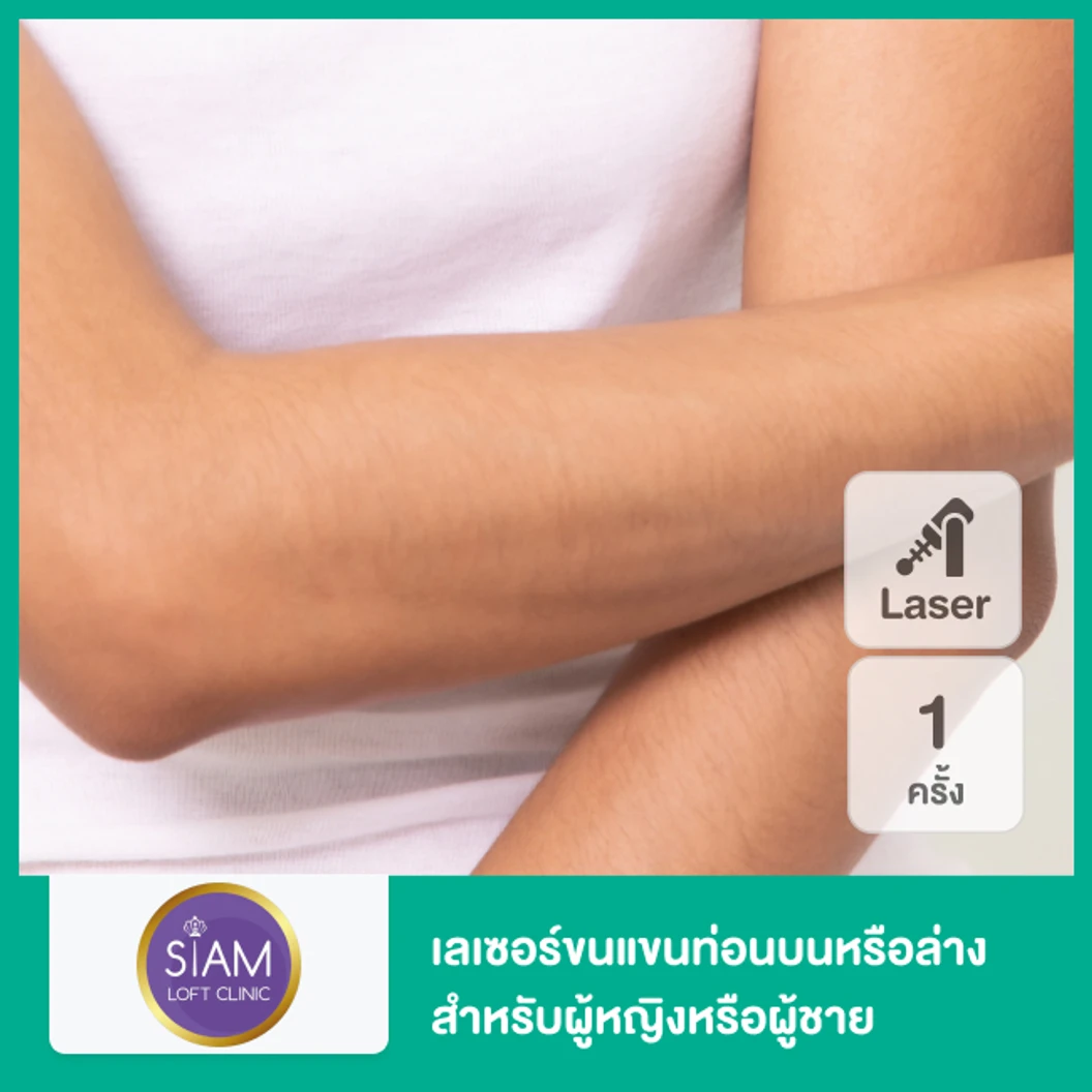 เลเซอร์ขนแขนท่อนบนหรือล่าง ด้วย Diode Laser 1 ครั้ง สำหรับผู้หญิงหรือผู้ชาย ที่ SIAMLOFT CLINIC สยามลอฟ์ท คลินิก เวชกรรม