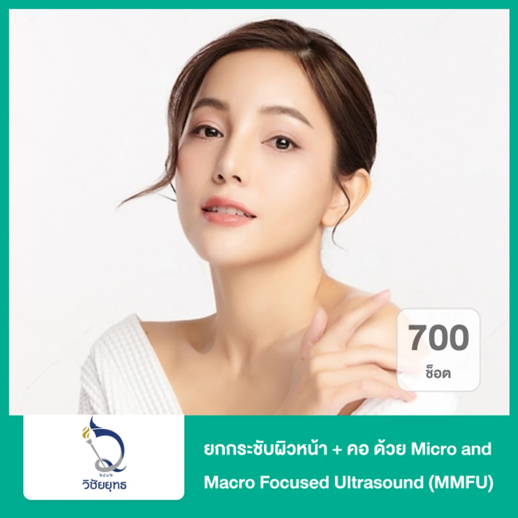 ยกกระชับผิวหน้า + คอ ด้วย Micro and Macro Focused Ultrasound MMFU 700 ช็อต ที่ โรงพยาบาลวิชัยยุทธ