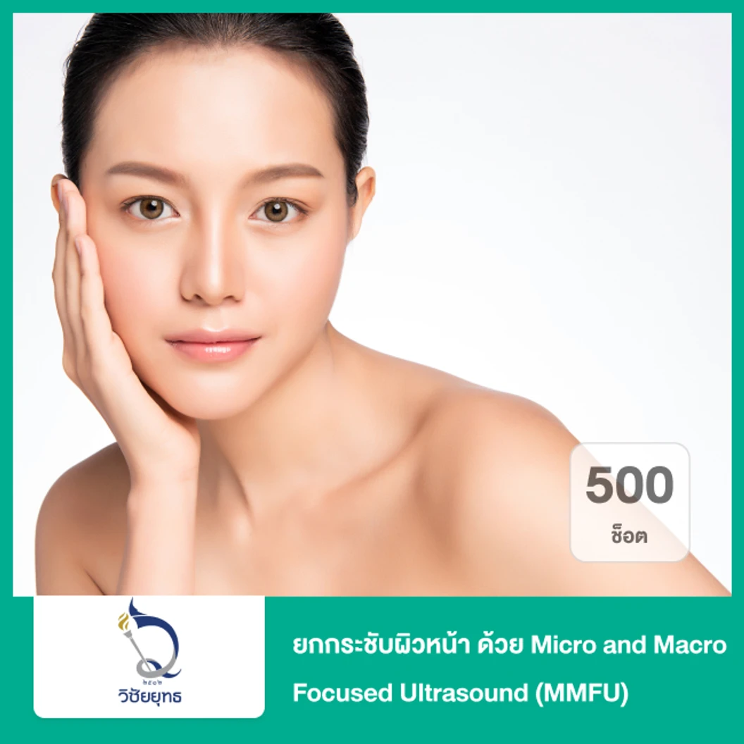 ยกกระชับผิวหน้า ด้วย Micro and Macro Focused Ultrasound MMFU 500 ช็อต ที่ โรงพยาบาลวิชัยยุทธ