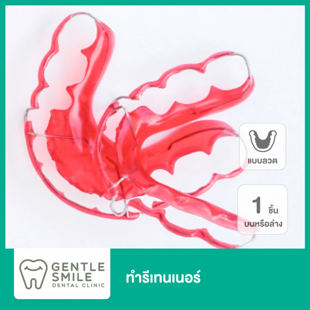 ทำรีเทนเนอร์แบบลวด 1 ชิ้น ฟันบนหรือล่าง ที่ Gentle Smile Dental Clinic