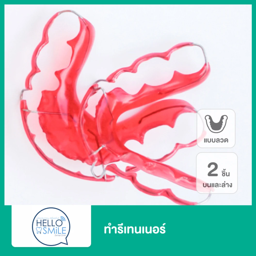 ทำรีเทนเนอร์แบบลวด 2 ชิ้น ฟันบนและล่าง ที่ Hello Smile Dental Clinic