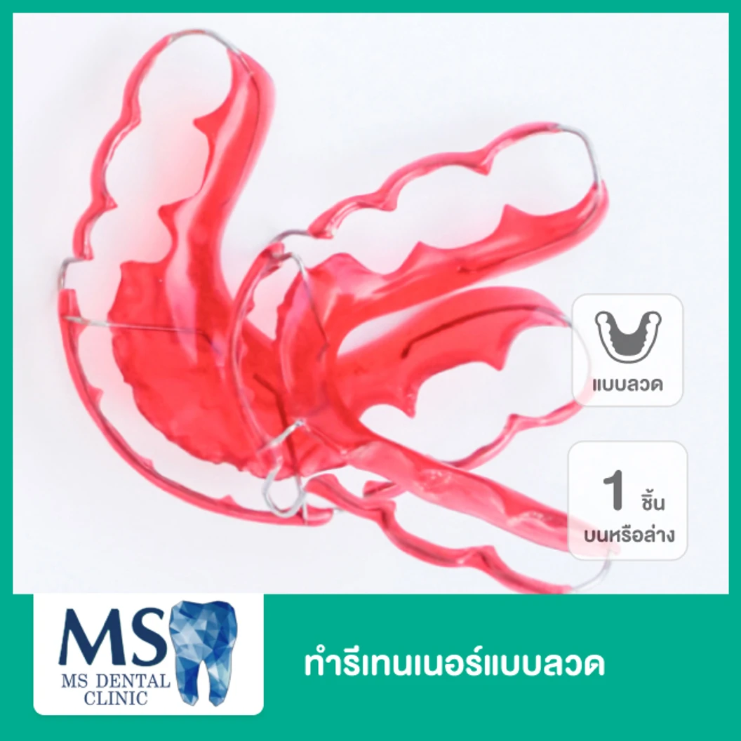 ทำรีเทนเนอร์แบบลวด 1 ชิ้น ฟันบนหรือล่าง ที่ MS Dental Clinic เอ็มเอสคลินิกทันตกรรม สุขุมวิท 39