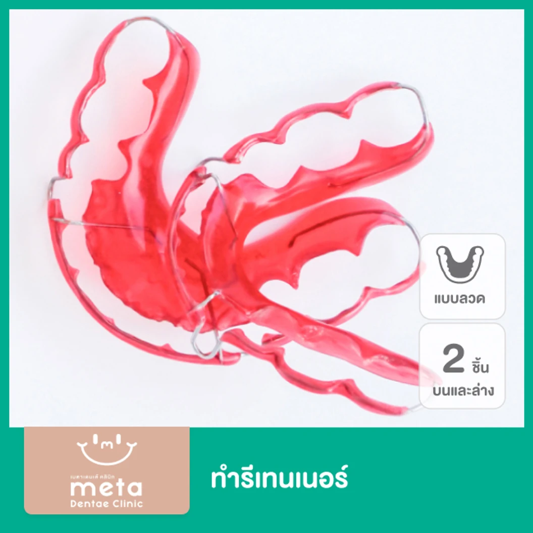 ทำรีเทนเนอร์แบบลวด 2 ชิ้น สำหรับฟันบนและล่าง ที่ Meta Dentae Clinic
