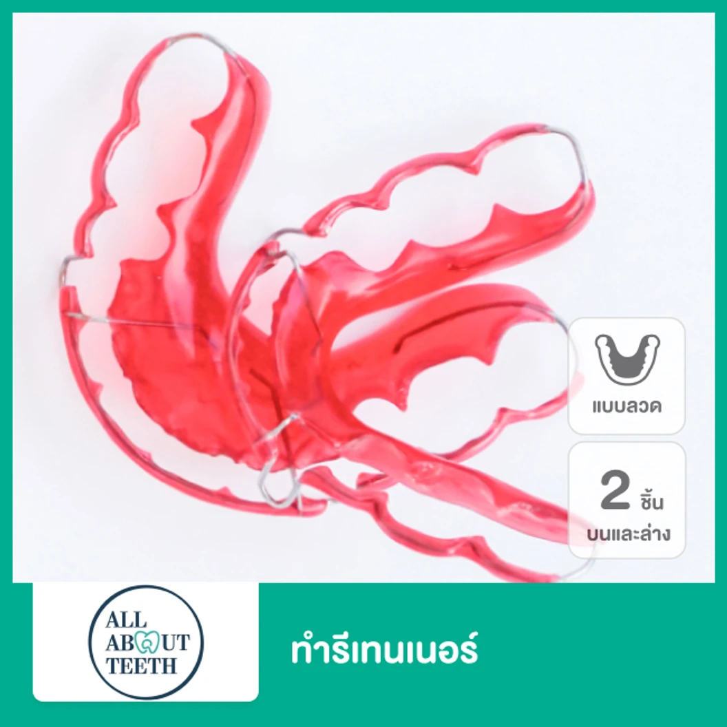 ทำรีเทนเนอร์แบบลวด 2 ชิ้น ฟันบนและล่าง ที่ All About Teeth Clinic