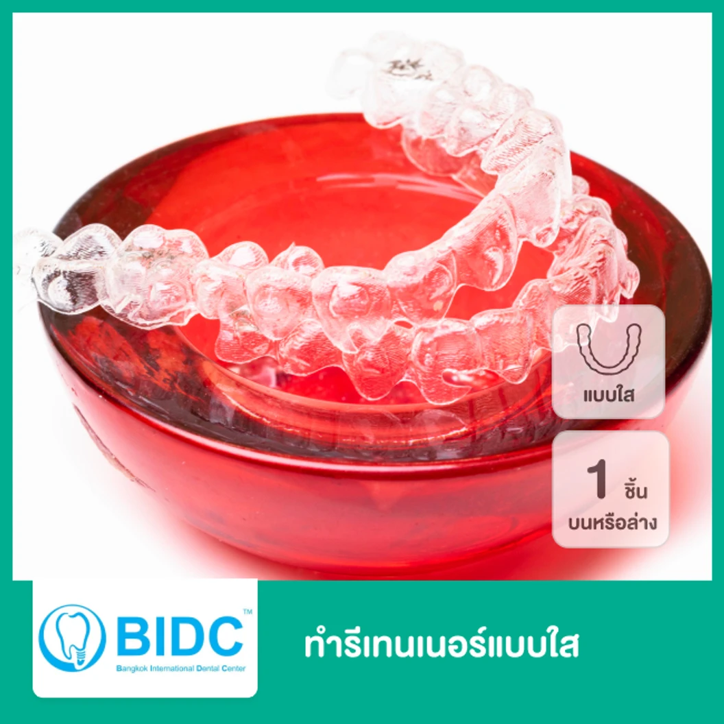 ทำรีเทนเนอร์แบบใส 1 ชิ้น ฟันบนหรือล่าง ที่ BIDC Dental Center BIDC