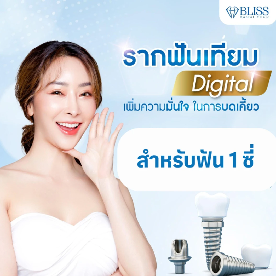 ทำรากฟันเทียมยี่ห้อ Osstem สำหรับฟัน 1 ซี่ ที่ Bliss Dental Clinic