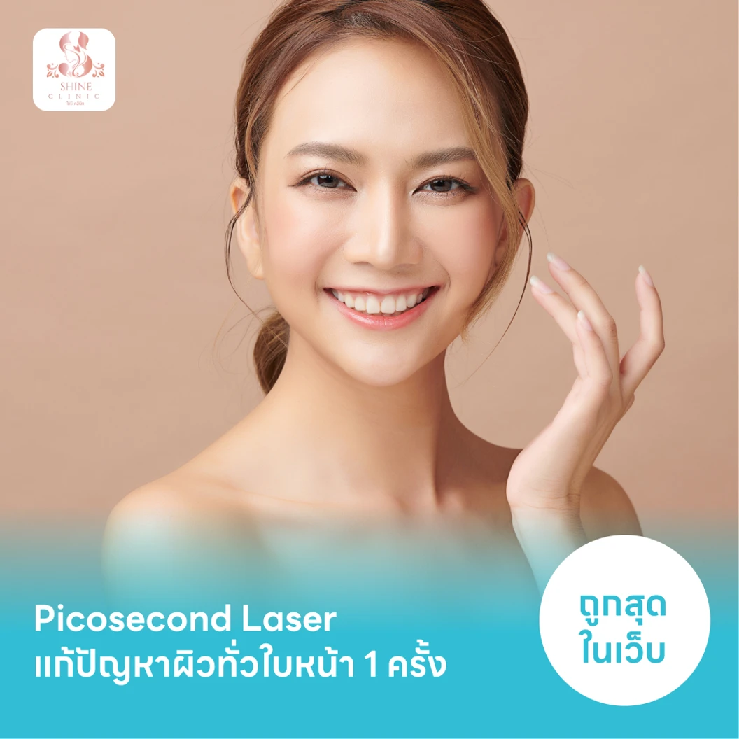 Picosecond Laser แก้ปัญหาผิวทั่วใบหน้า 1 ครั้ง จำกัด 1 ท่านต่อ 1 สิทธิ์ เท่านั้น แพ็กเกจ HDmall+ ที่ ไชน์คลินิก Shine Clinic