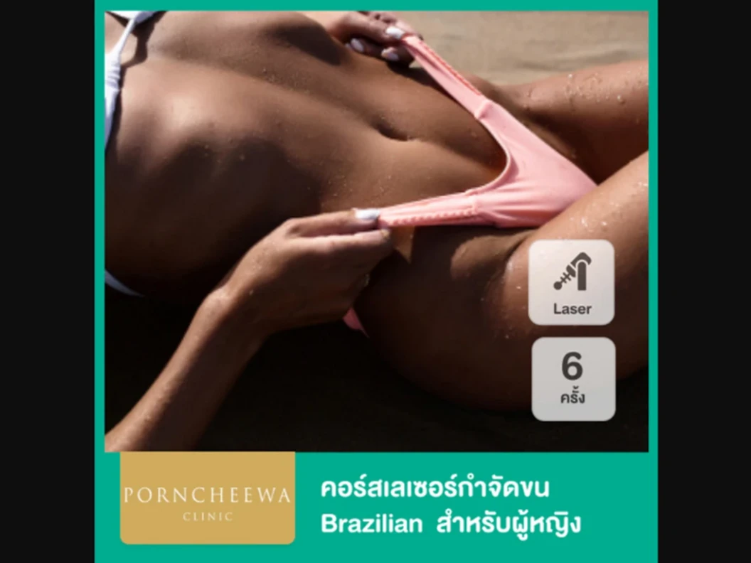 คอร์สกำจัดขน Brazilian ด้วยเลเซอร์ Premium Ice Diode 6 ครั้ง สำหรับผู้หญิงเท่านั้น ที่ Porncheewa Clinic