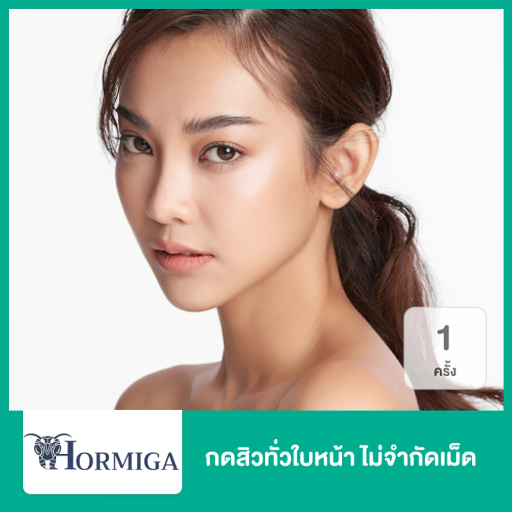 กดสิวทั่วใบหน้า ไม่จำกัดเม็ด 1 ครั้ง ที่ Hormiga