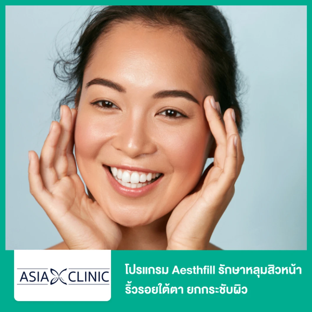 โปรแกรม Aesthfill รักษาหลุมสิวหน้า ริ้วรอยใต้ตา ยกกระชับผิว ที่ Asia Clinic เอเซียคลินิก