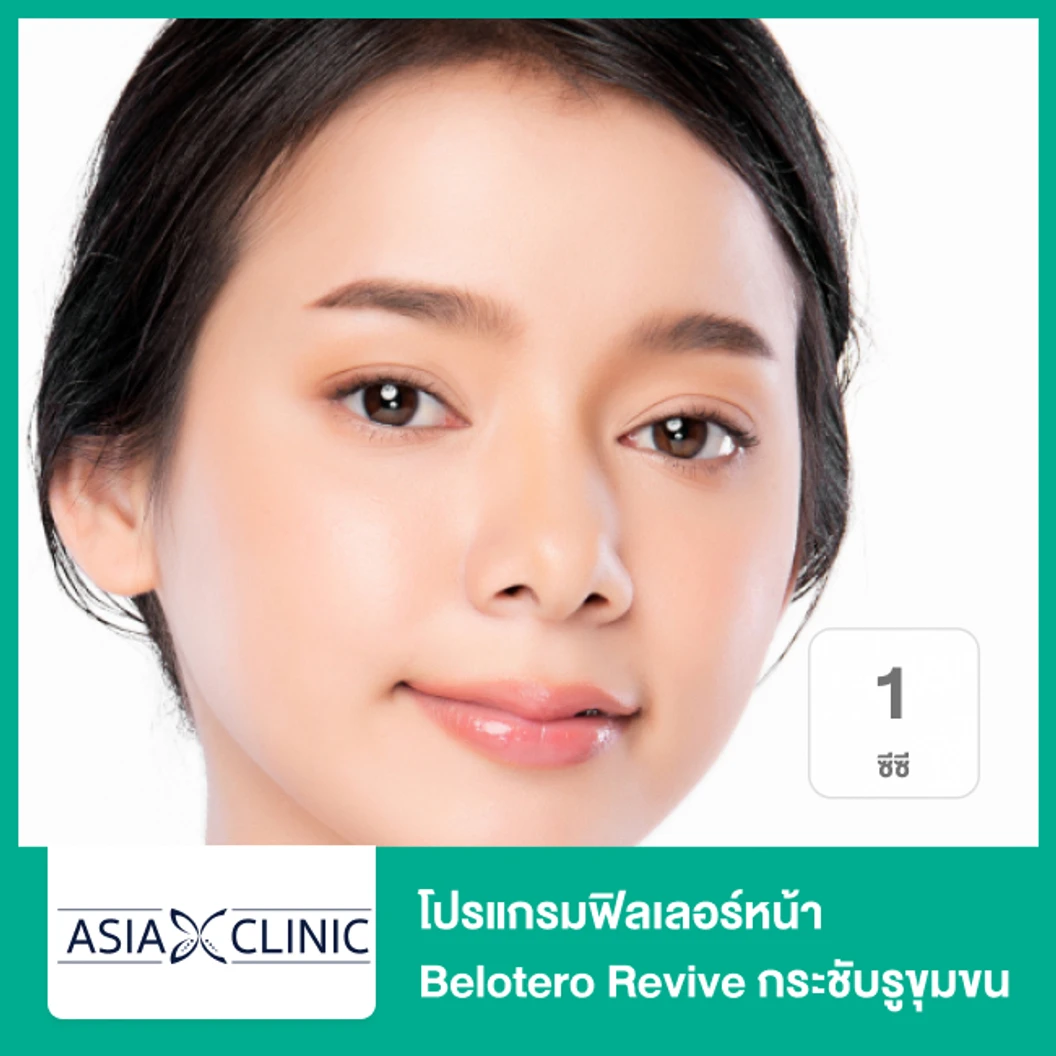 โปรแกรมฟิลเลอร์ 1 ซีซี หน้า ที่ Asia Clinic เอเซียคลินิก