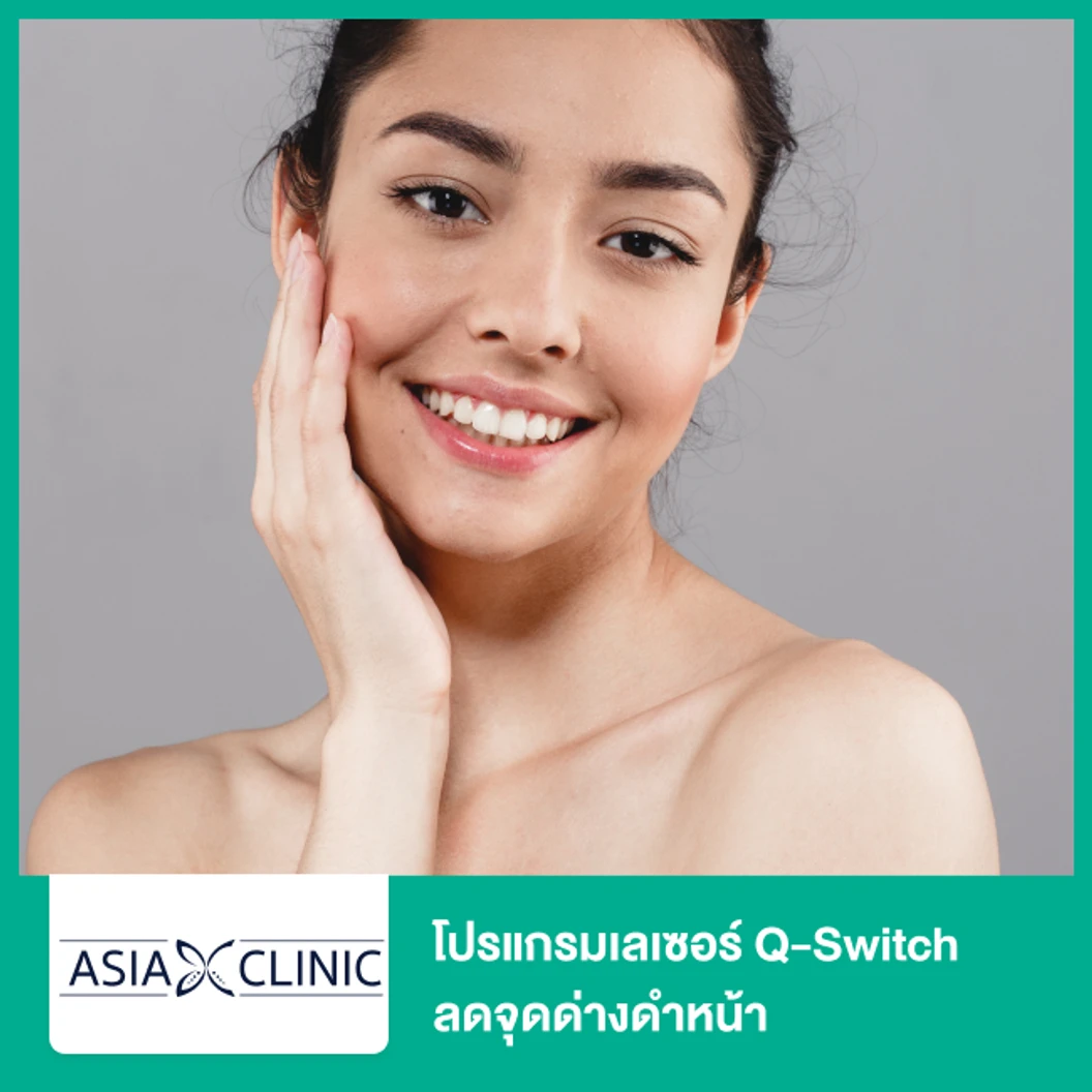 โปรแกรมเลเซอร์ Q-Switch ลดจุดด่างดำหน้า ที่ Asia Clinic เอเซียคลินิก