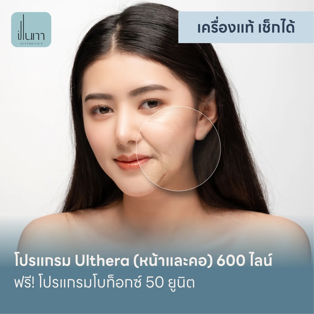 โปรแกรม Ulthera หน้าและคอ 600 ไลน์ ฟรี! โปรแกรมโบท็อกซ์ 50 ยูนิต แพ็กเกจ HDmall+ ที่ ILLUM Aesthetic Clinic